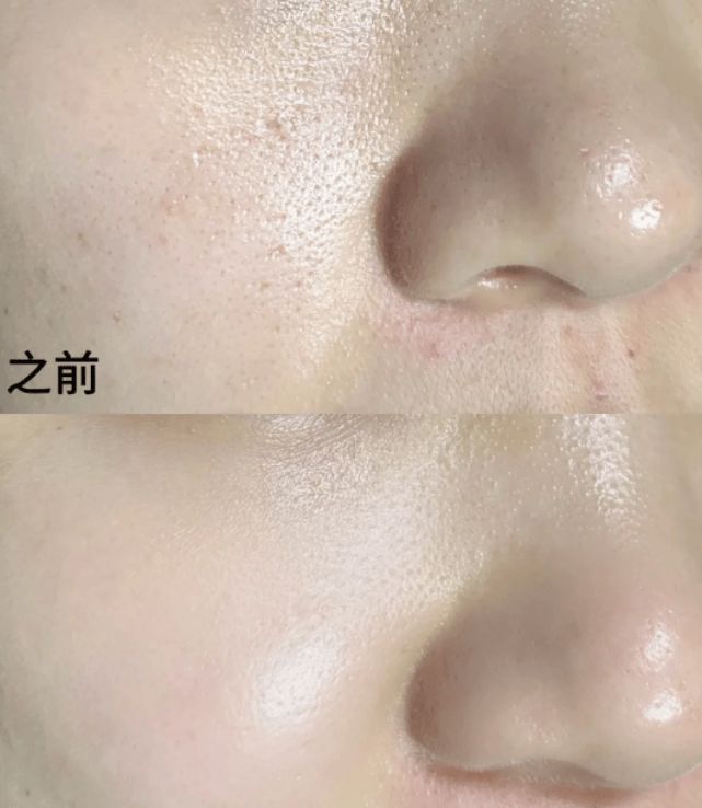最好用的十大面膜2024年最好用的十大面膜你绝对不能错过(图4)